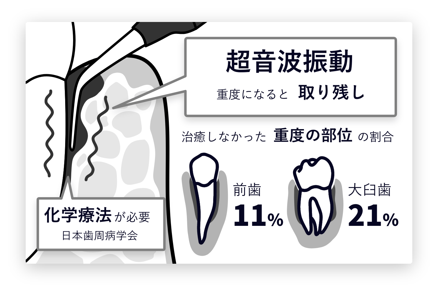 従来の歯周病治療との比較