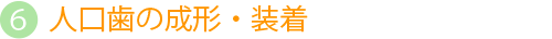 人口歯の成形・装着
